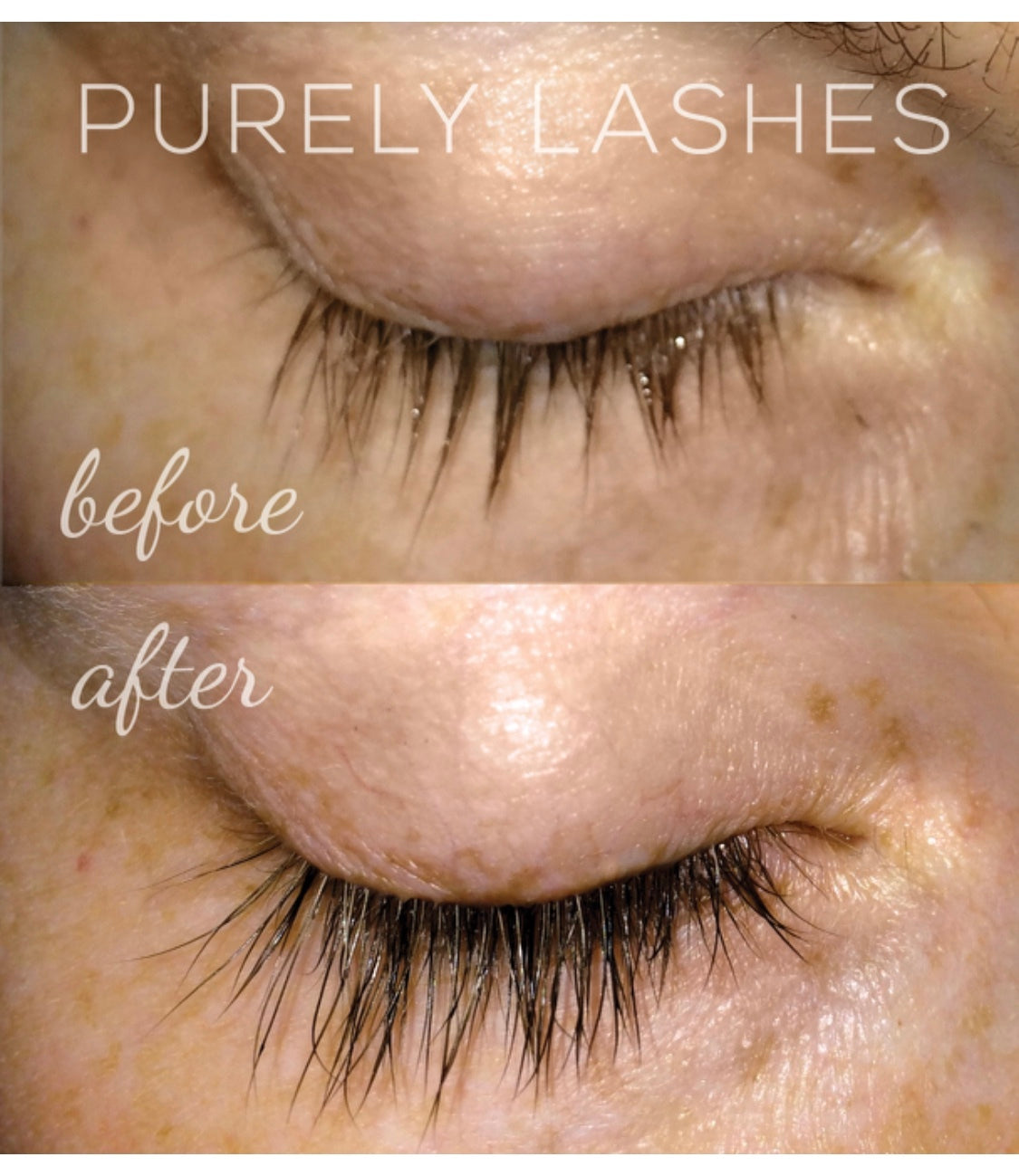 Purely lashes growth serum - the more you buy the more you save!
